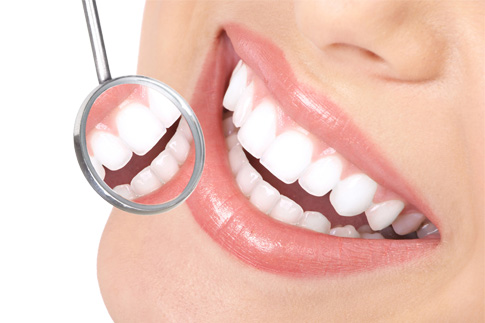dental implants india